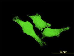 Anti-ERBB2 Mouse Monoclonal Antibody [clone: 4E1]