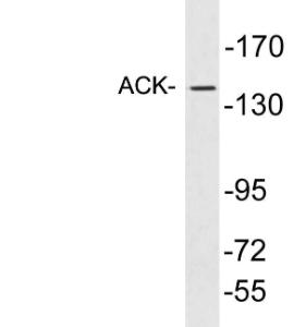 Western blot analysis of lysates from EOC20 cells using Anti-ACK Antibody