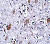 Anti-ATOH8 Rabbit Polyclonal Antibody