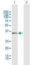 Anti-DUSP12 Rabbit Polyclonal Antibody