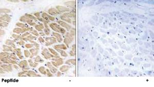 Anti-MIA Rabbit Polyclonal Antibody