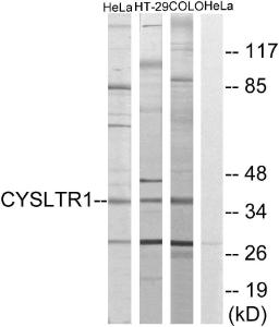 Antibody anti-cyst R1 A99258-100 100 µg