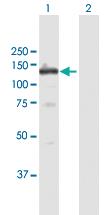 Anti-PRKD1 Mouse Polyclonal Antibody