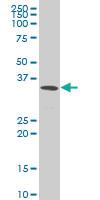 Anti-PDLIM1 Mouse Polyclonal Antibody