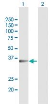 Anti-SULT1B1 Rabbit Polyclonal Antibody