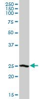 Anti-DCXR Mouse Polyclonal Antibody