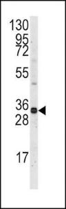 Anti-MCL1 Rabbit Polyclonal Antibody (AP (Alkaline Phosphatase))