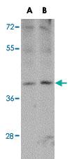 Anti-ATOH8 Rabbit Polyclonal Antibody