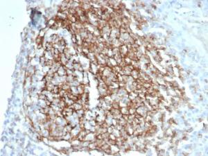 Immunohistochemical analysis of formalin-fixed, paraffin-embedded human kidney tissue using Anti-CD35 Antibody [CR1/7016R] at 2µg/ml