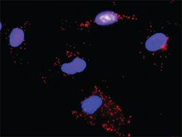 Anti-EGFR + ERBB2 Antibody Pair