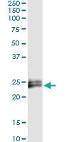 Anti-IFNE Antibody Pair