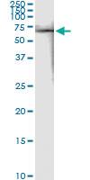 Anti-FKBP4 Antibody Pair