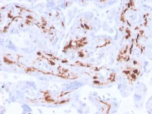 Immunohistochemical analysis of formalin-fixed, paraffin-embedded human placenta using Anti-Factor XIIIa Antibody [F13A1/3772R]