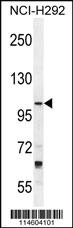 Anti-TLL2 Rabbit Polyclonal Antibody