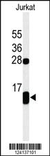 Anti-PLB-T17 Rabbit Polyclonal Antibody