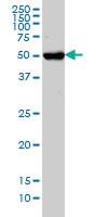 Anti-CHST3 Mouse Monoclonal Antibody [clone: 1C4]