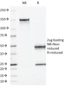 Anti-Moesin antibody