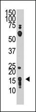 Anti-THY1 Rabbit Polyclonal Antibody