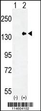 Anti-TLL2 Rabbit Polyclonal Antibody