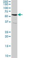 Anti-RIOK3 Rabbit Polyclonal Antibody