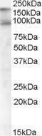 Anti-CDCP1 Antibody (A82673) (1 µg/ml) staining of Human Colon lysate (35 µg protein in RIPA buffer) Primary incubation was 1 hour Detected by chemiluminescence