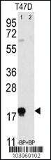 Anti-THY1 Rabbit Polyclonal Antibody