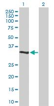 Anti-DUSP12 Rabbit Polyclonal Antibody