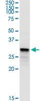 Anti-SULT1B1 Rabbit Polyclonal Antibody