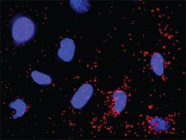 Anti-EGFR + PIK3R3 Antibody Pair