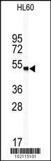 Anti-WISP1 Rabbit Polyclonal Antibody (HRP (Horseradish Peroxidase))