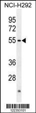 Anti-ACTL7A Rabbit Polyclonal Antibody (AP (Alkaline Phosphatase))