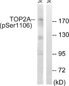 Western blot analysis of lysates from Jurkat cells treated with paclitaxel 1uM 24h using Anti-TOP2A (phospho Ser1106) Antibody. The right hand lane represents a negative control, where the antibody is blocked by the immunising peptide