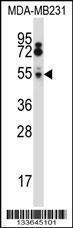 Anti-HTRA2 Rabbit Polyclonal Antibody (APC (Allophycocyanin))