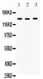 Anti-Angiotensin Converting Enzyme 1 Rabbit Antibody