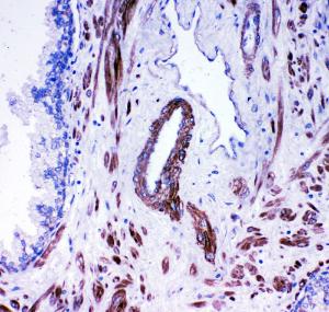 Anti-Angiotensin Converting Enzyme 1 Rabbit Antibody