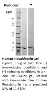 Human recombinant procalcitonin (from <i>E. coli</i>)