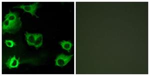 Antibody anti-cyst R1 A99258-100 100 µg