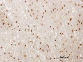 Anti-SMAD6 Mouse Monoclonal Antibody [clone: 4F3]