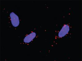 Anti-EGFR + PIK3R1 Antibody Pair