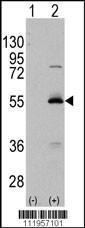 Anti-ALDH6A1 Rabbit Polyclonal Antibody (APC (Allophycocyanin))