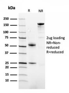 SDS-PAGE analysis of Anti-FABP1 Antibody [FABP1/3482] under non-reduced and reduced conditions; showing intact IgG and intact heavy and light chains, respectively. SDS-PAGE analysis confirms the integrity and purity of the antibody.