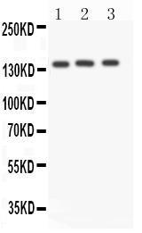 Anti-Angiotensin Converting Enzyme 1 Rabbit Antibody