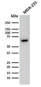 Western blot analysis of human MDA-231 cell lysate using Anti-GnRHR Antibody [F1G4]