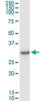 Anti-SULT1B1 Rabbit Polyclonal Antibody