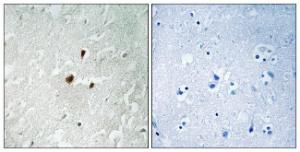 Immunohistochemical analysis of paraffin-embedded human brain using Anti-TIF-IA (phospho Ser649) Antibody. The right hand panel represents a negative control, where the antibody was pre-incubated with the immunising peptide