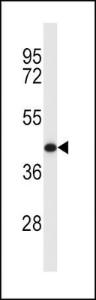 Anti-MCL1 Rabbit Polyclonal Antibody (AP (Alkaline Phosphatase))