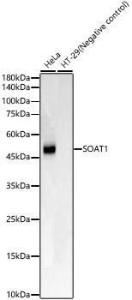 Western blot analysis of various lysates, using Anti-SOAT 1/ACAT1 Antibody [ARC59877] (A309855) at 1:1000 dilution. The secondary Antibody was Goat Anti-Rabbit IgG H&L Antibody (HRP) at 1:10000 dilution. Lysates/proteins were present at 25 µg per lane