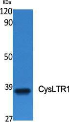 Antibody anti-cyst R1 A99258-100 100 µg