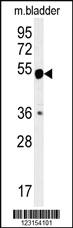 Anti-CALR Rabbit Polyclonal Antibody