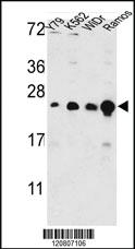 Anti-GSTP1 Rabbit Polyclonal Antibody